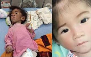 Bất ngờ trước hình ảnh mới nhất của em bé Lào Cai 14 tháng tuổi chỉ nặng 3,5 kg